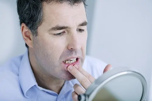 man examines his gums